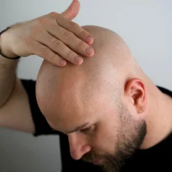 BetterBeBold Kaljun Hoito>Magic Bald Head & Beard Oil 30ml